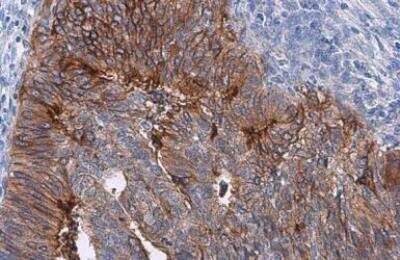 Immunohistochemistry-Paraffin: Coagulation Factor III/Tissue Factor Antibody [NBP2-15139]