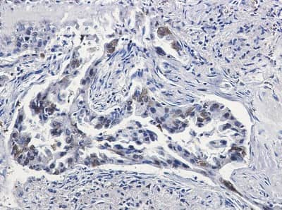 Immunohistochemistry-Paraffin: Coagulation Factor III/Tissue Factor Antibody (S04-7G2) [NBP3-14883]