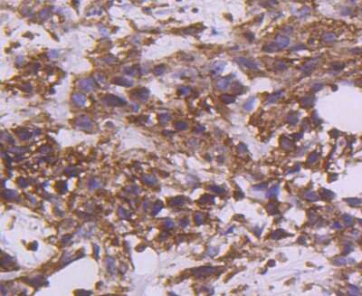 Immunohistochemistry-Paraffin: Coagulation Factor III/Tissue Factor Antibody (SN20-16) [NBP2-67731]