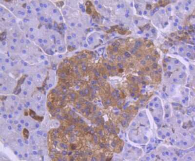 Immunohistochemistry-Paraffin: Coagulation Factor III/Tissue Factor Antibody (SN20-16) [NBP2-67731]