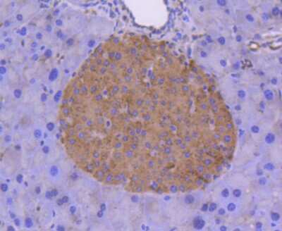 Immunohistochemistry-Paraffin: Coagulation Factor III/Tissue Factor Antibody (SN20-16) [NBP2-67731]