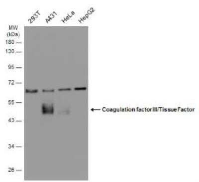 Western Blot: Coagulation Factor III/Tissue Factor Antibody [NBP2-15139]