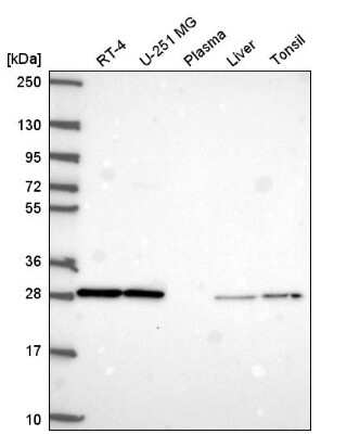 Western Blot: Coagulation Factor III/Tissue Factor Antibody [NBP2-55950]