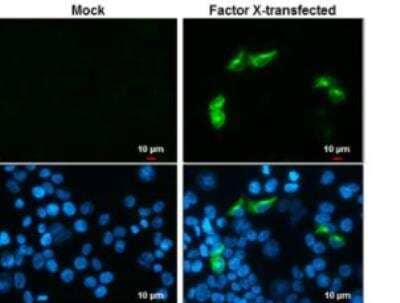 Immunocytochemistry/ Immunofluorescence: Coagulation Factor X Antibody (268) [NBP2-43703]