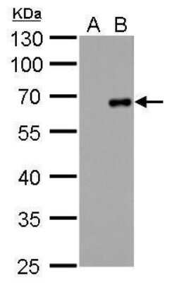 Western Blot: Coagulation Factor X Antibody (268) [NBP2-43703]