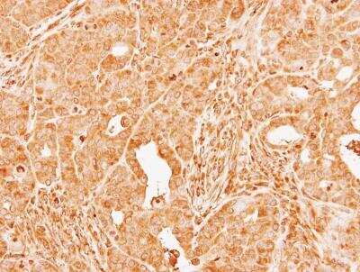 Immunohistochemistry-Paraffin: Coagulation Factor X Antibody [NBP1-33320]