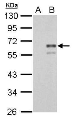 Western Blot: Coagulation Factor X Antibody [NBP1-33320]