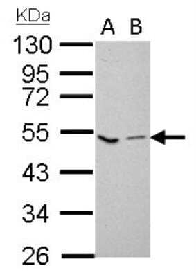 Western Blot: Coagulation Factor X Antibody [NBP1-33320]