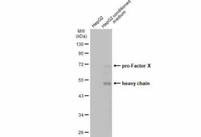 Western Blot: Coagulation Factor X Antibody [NBP1-33320]