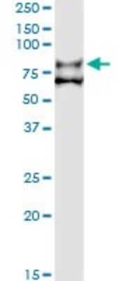 Immunoprecipitation: Coagulation Factor XI Antibody (2H8) [H00002160-M01]