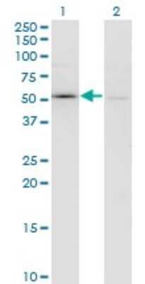 Western Blot: Coagulation Factor XI Antibody (2H8) [H00002160-M01]