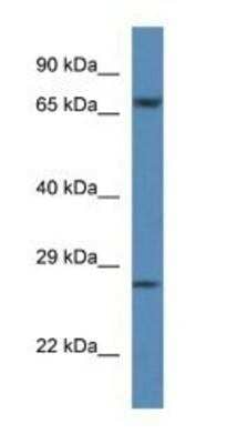 Western Blot: Coagulation Factor XI Antibody [NBP1-74234]