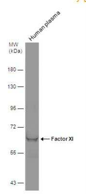 Western Blot: Coagulation Factor XI Antibody [NBP2-16404]