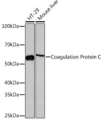 Western Blot: Coagulation Factor XIV/Protein C Antibody (3W3R7) [NBP3-16427]