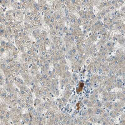 Immunohistochemistry-Paraffin: Coagulation Factor XIV/Protein C Antibody [NBP1-86509]