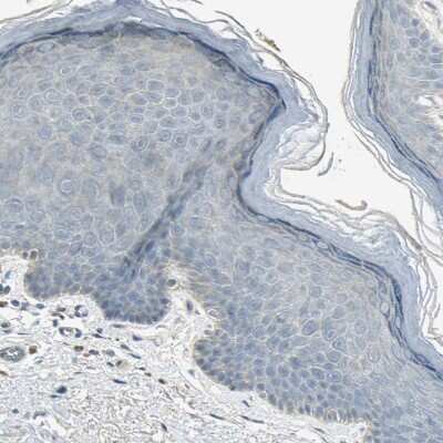 Immunohistochemistry-Paraffin: Coagulation Factor XIV/Protein C Antibody [NBP1-86509]