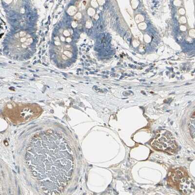 Immunohistochemistry-Paraffin: Coagulation Factor XIV/Protein C Antibody [NBP1-86509]