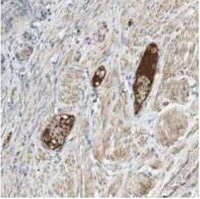 ELISA: Coagulation Factor XIV/Protein C Antibody (PC 7) - BSA Free [NBP1-05113]