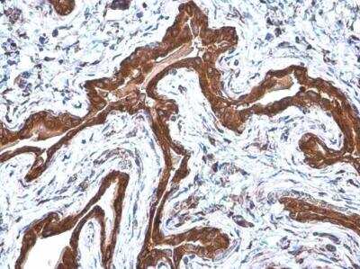 Immunohistochemistry-Paraffin: Coatomer Subunit Delta Antibody (1318) [NBP2-43608]