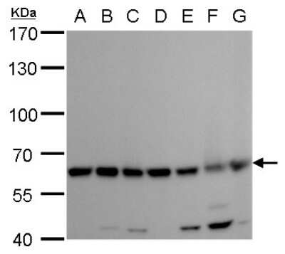 Western Blot: Coatomer Subunit Delta Antibody (1318) [NBP2-43608]