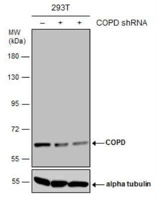 Western Blot: Coatomer Subunit Delta Antibody (1318) [NBP2-43608]