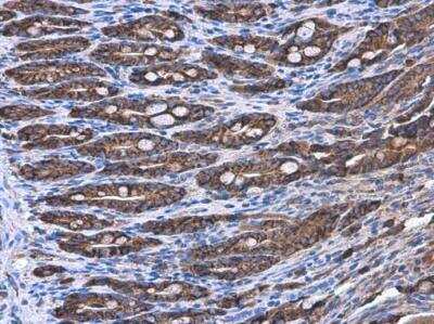 Immunohistochemistry-Paraffin: Coatomer Subunit Delta Antibody (189) [NBP2-43773]
