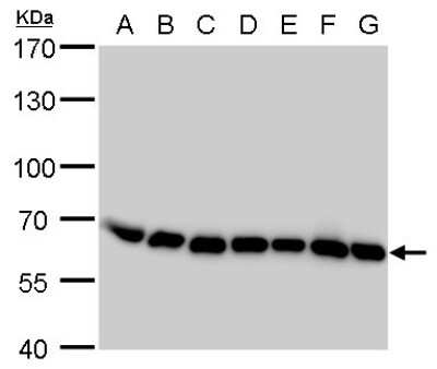 Western Blot: Coatomer Subunit Delta Antibody (189) [NBP2-43773]