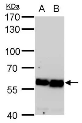 Western Blot: Coatomer Subunit Delta Antibody (189) [NBP2-43773]