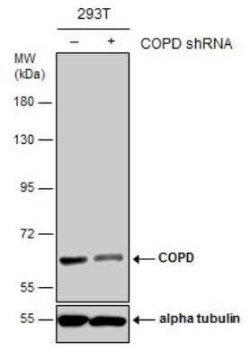 Western Blot: Coatomer Subunit Delta Antibody (189) [NBP2-43773]