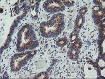 Immunohistochemistry-Paraffin: Coatomer Subunit Delta Antibody (OTI6A6) [NBP2-01791]