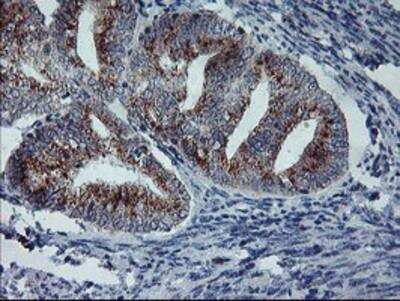Immunohistochemistry-Paraffin: Coatomer Subunit Delta Antibody (OTI6A6) [NBP2-01791]