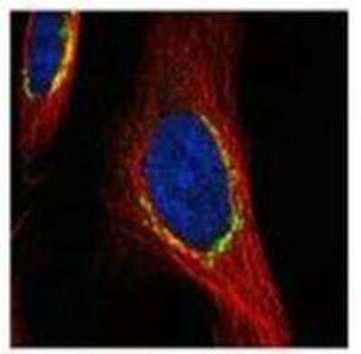Immunocytochemistry/ Immunofluorescence: Coatomer Subunit Delta Antibody [NBP1-32377]