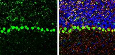 Immunohistochemistry-Frozen: Coatomer Subunit Delta Antibody [NBP1-32377]