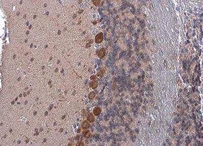 Immunohistochemistry-Paraffin: Coatomer Subunit Delta Antibody [NBP1-32377]