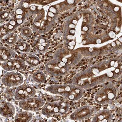 Immunohistochemistry-Paraffin: Coatomer Subunit Delta Antibody [NBP1-85515]