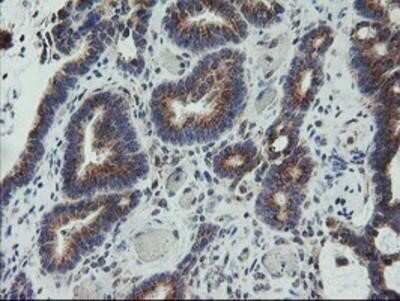 Immunohistochemistry: Coatomer Subunit Delta Antibody (OTI6A6) - Azide and BSA Free [NBP2-70203]