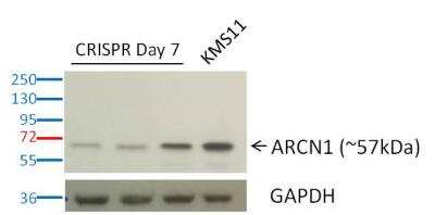 Western Blot: Coatomer Subunit Delta Antibody [NBP1-32377]