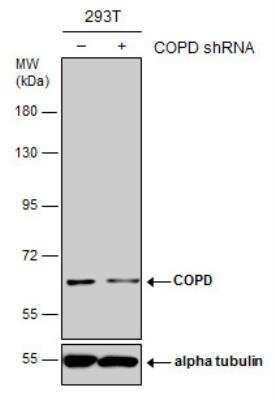 Western Blot: Coatomer Subunit Delta Antibody [NBP1-32377]