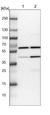 Western Blot: Coatomer Subunit Delta Antibody [NBP1-85515]