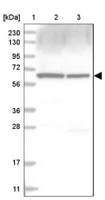 Western Blot: Coatomer Subunit Delta Antibody [NBP1-85515]