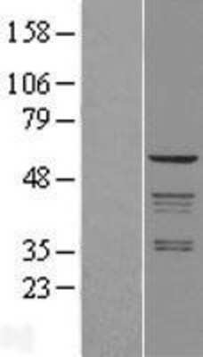 Western Blot: Coatomer Subunit Delta Overexpression Lysate [NBL1-07646]