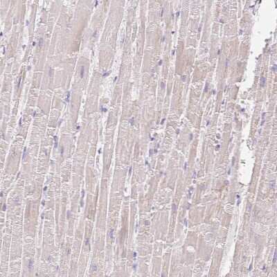 Immunohistochemistry-Paraffin: Coatomer protein complex, subunit zeta 2 Antibody [NBP2-30435]