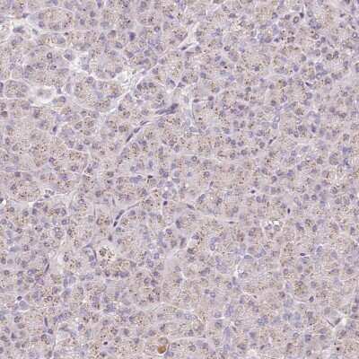 Immunohistochemistry-Paraffin: Coatomer protein complex, subunit zeta 2 Antibody [NBP2-30435]