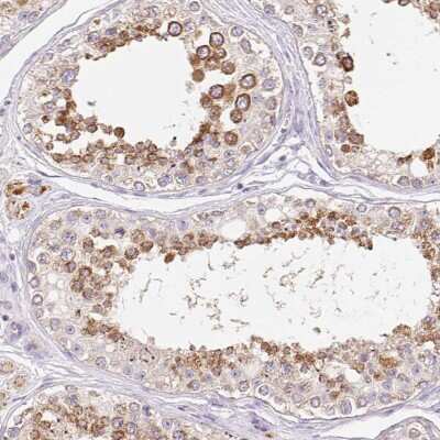 Immunohistochemistry-Paraffin: Coatomer protein complex, subunit zeta 2 Antibody [NBP2-30435]
