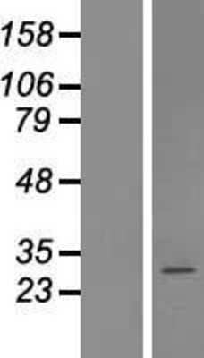Western Blot: Coatomer protein complex, subunit zeta 2 Overexpression Lysate [NBL1-09388]