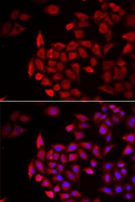 Immunocytochemistry/ Immunofluorescence: Cochlin Antibody - BSA Free [NBP2-92904]