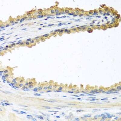 Immunohistochemistry-Paraffin: Cochlin Antibody - BSA Free [NBP2-92904]