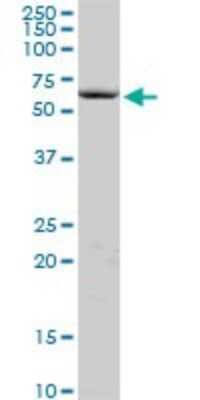 Western Blot: Cochlin Antibody [H00001690-B01P]