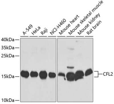 Western Blot: Cofilin 2 AntibodyBSA Free [NBP2-92683]