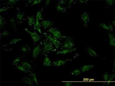 Immunocytochemistry/ Immunofluorescence: Cofilin 2 Antibody (6G9) [H00001073-M03]